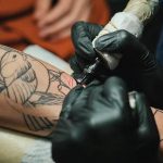 Reliable Laser Tattoo Removal Mississauga