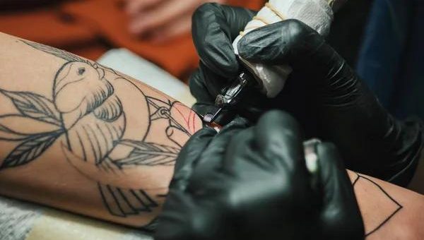 Reliable Laser Tattoo Removal Mississauga