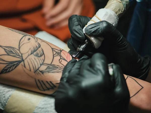 Reliable Laser Tattoo Removal Mississauga