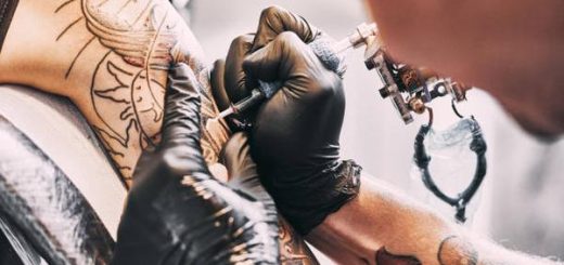 Mississauga's Safe Tattoo Removal Procedures