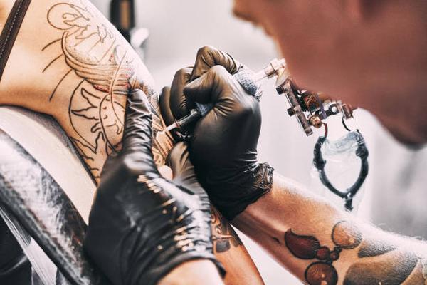 Mississauga's Safe Tattoo Removal Procedures